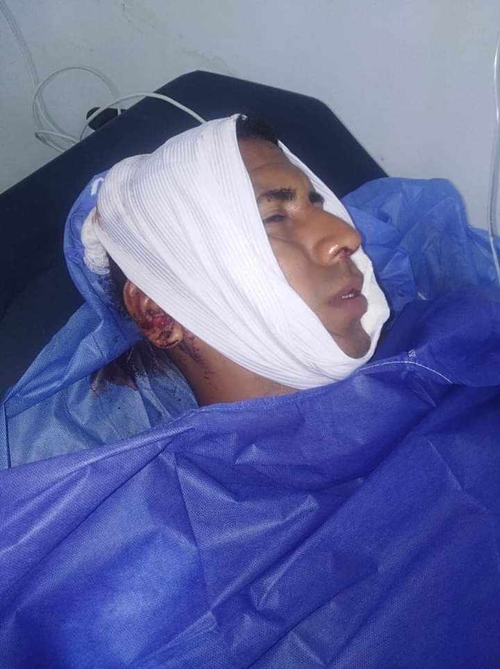 Tonny Rafael Menco Zambrano, de 30 años, lesionado