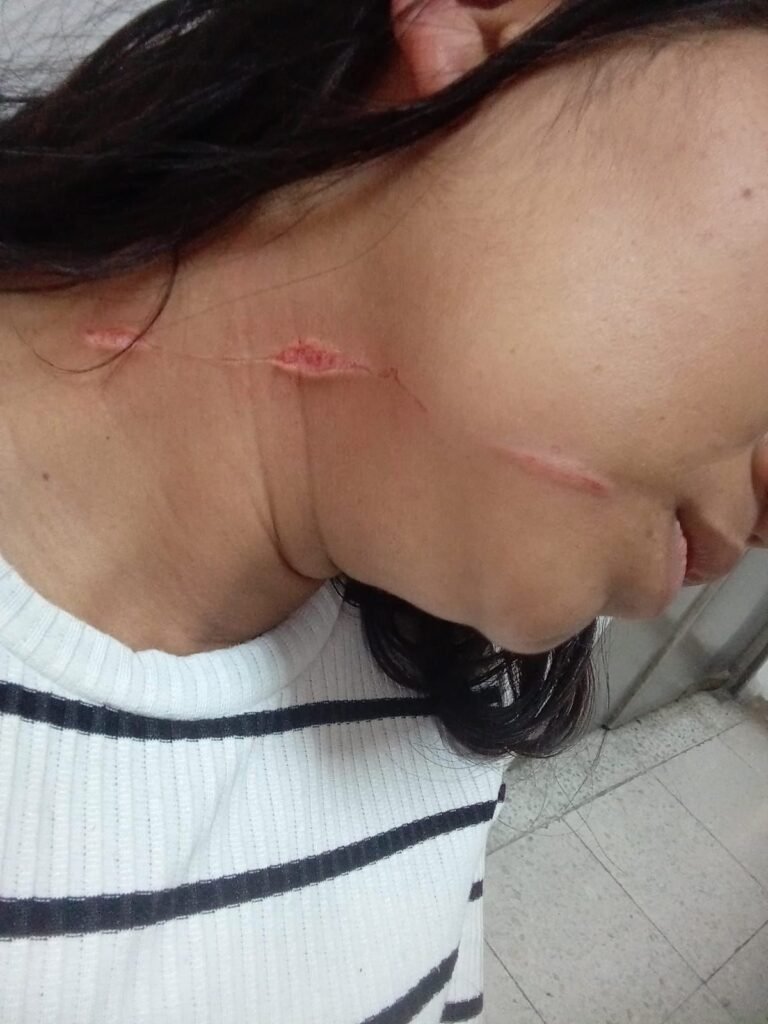 Mujer de La Guajira residente en Bogotá, fue víctima de intento de homicidio por parte de su expareja, quien está obsesionado en matarla