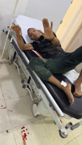 Joven resultó gravemente herido al caer en hueco sin señalizar por obras de alcantarillado en Fonseca